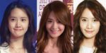 Yoona Plastic Surgery