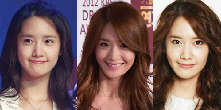 yoona plastic surgery